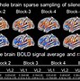 Image result for How Many Percent of Are Brain Do We Use