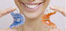 apparecchio mobile apparecchio mobile dentista roma apparecchio mobile apparecchio mobile dentista roma