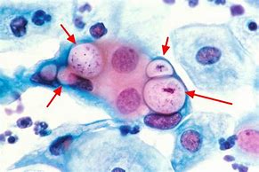 Image result for Chlamydia Trachomatis Structure