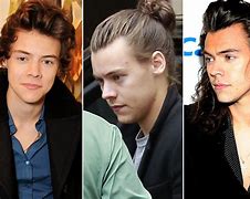 Image result for Harry Styles Hair Loss