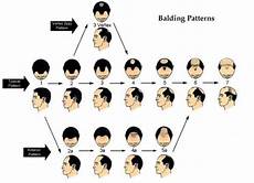 Hair Loss 101 Bauman Medical Group