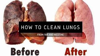 Image result for Tar Coats Lungs