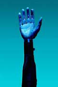 Image result for First Prosthetic Arm