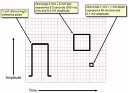Image result for Inch Measurements Chart to mm