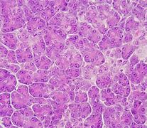 Image result for Real Life Human Pancreas