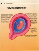 Image result for Chlamydia in Pregnancy