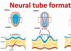 Image result for Neural Tube Anatc