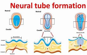 Image result for Neural Tube in Embryo