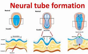 Image result for Notochord Neural Tube
