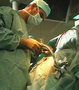 Image result for Brain Operation