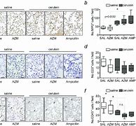 Image result for IHC Quantification