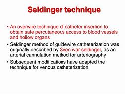 Image result for Seldinger Technique for Ascites