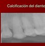 Image result for calcifucar