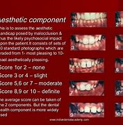 Image result for Aesthetic Component
