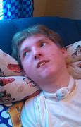 Image result for Person with Lissencephaly