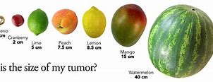 Image result for How Big Is 6Mm Tumor