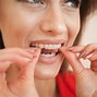 Image result for Byte Aligners Overbite