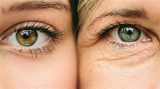 Image result for Photoaging
