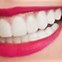 Image result for Jojo Siwa Teeth