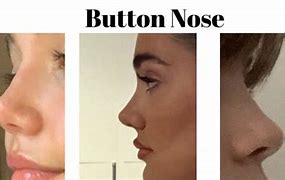 Image result for Pointed Button Nose