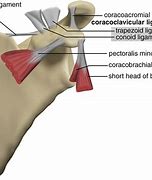 Image result for coracoides