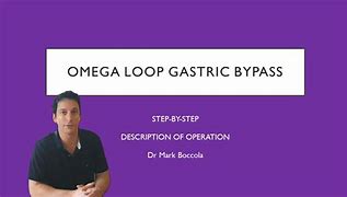 Image result for Omega Loop Bypass