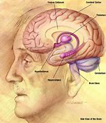 Image result for Brain Surgery Cartoon