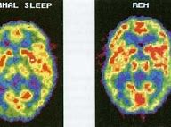 Image result for Brain Activity during REM Sleep