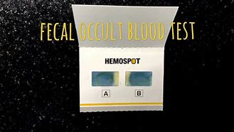 Image result for Positive Hemoccult Card