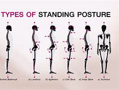 Posture 的图像结果