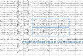 Image result for Wicket Waves