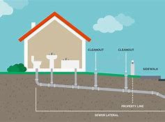 Image result for Uresil Tru-Close Suction Drainage System
