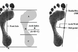 Image result for Foot Length Compared to Arch Lenghth Measurements