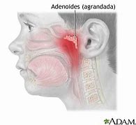 Image result for adeniso