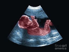 Image result for Fetal Ultrasound White Background