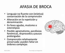 Image result for aripsia
