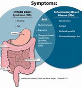 Image result for IBD Examples