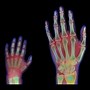 Image result for Brian Bones X-ray