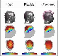 Image result for Intelligent Reflecting Surface in the Scalp