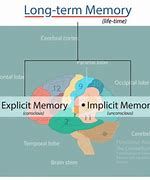 Image result for Types of Non Declarative Memory