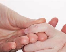 Image result for Warts On Children