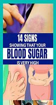 Image result for High Blood Sugar Meme