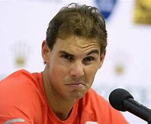 Image result for Rafael Nadal Balding