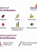 Image result for Sickle Cell Disease Early Symptoms