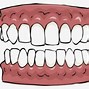 Image result for False Teeth Clip Art