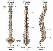 Image result for Lumbar Spine Disc