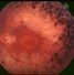 Image result for Retina Cones