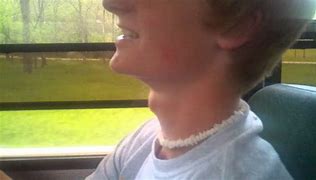 Image result for Noticable Adams Apple