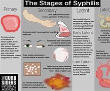 Image result for Gonorrhea and Chlamydia Symptoms