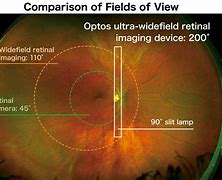 Image result for retinal displays benefit